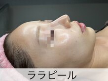 マドモアゼル 麻布十番/ララピール