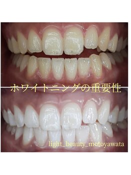ライトビューティー 本八幡店(LIGHT BEAUTY)/お客様ビフォーアフター♪