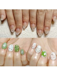 深爪矯正/10本長さ出し&アート