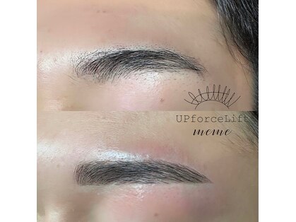 アップフォースリフト(UPforceLift)の写真