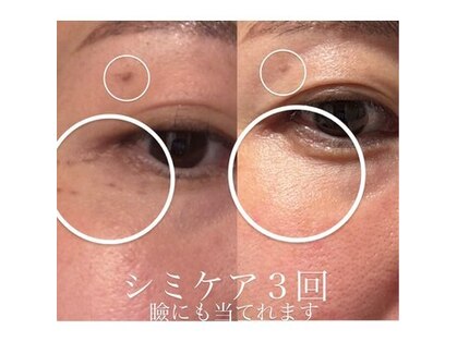 ミエル(miel)の写真