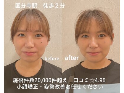 リファイン整体院 国分寺店の写真