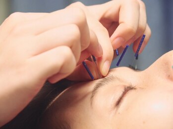 ビハダ(BIHADA)/頭痛や眼精疲労にお悩みの方も♪