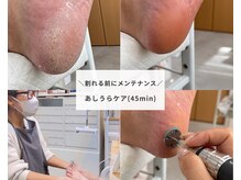クレーネイル(KLEE NAIL)の雰囲気(隠れ人気メニュー【角質ケア!!】割れる前にしっかりお手入れ♪)