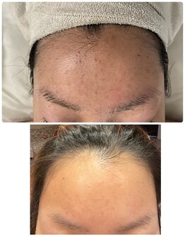 リシア(RECIA)/ホームケアのご提案