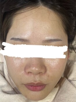 リズ(Liz)の写真/《結果重視の最新マシン◆アイスナイフで速攻たるみケア》肌深部へ働きかけハリ・弾力に満ちたお肌をGET!