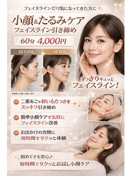 アプロ(Aphro)/フェイスライン変化