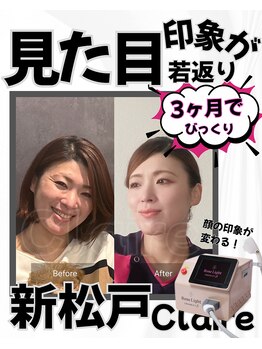 クレール 新松戸(Claire)/小顔&肌質改善/小顔リフトアップ