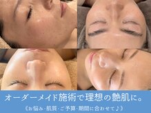 シュリー(Sriii)の雰囲気（インディバ/エンビロン/ピーリング3種を組み合わせてツヤ美肌へ）