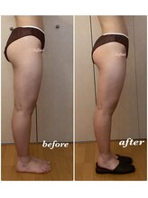 アンフィニ(infini)/下半身徹底、短期集中コース