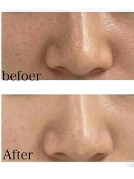 リッチベル(richbelle)/毛穴がつるん♪