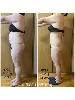 フィカス(FICUS)/モニター様