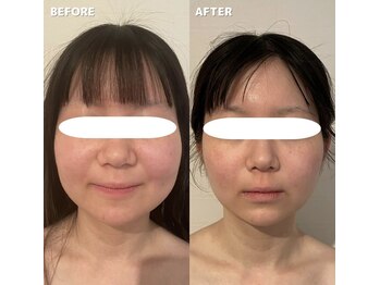 エッセンスビー 六本木/輪郭3点