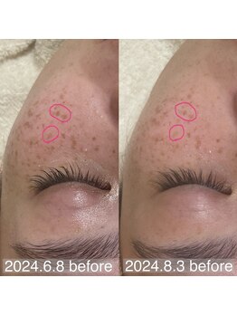 アルム(a'lm)/再生☆幹細胞×美白フェイシャル