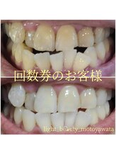 ライトビューティー 本八幡店(LIGHT BEAUTY)/お客様ビフォーアフター♪ 