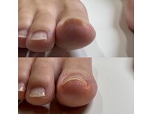 はなまる鍼灸整骨院の雰囲気（大好評巻き爪施術、お気軽にご相談ください。）