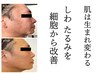 【しわたるみ】肌年齢を巻き戻す エイジングリフトフェイシャル17600→14080