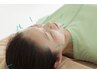 【お試し価格♪ 】美容鍼体験 　45分￥4,500→￥4,000