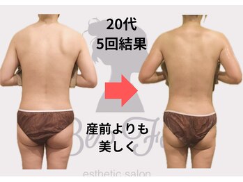 ビーフォー(be for)/20代　5回コース結果♪