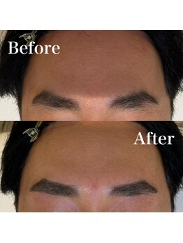 モテテ(motete)/お客様施術例☆栄本店