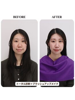 シュアリー(Surely)/トータルコースお客様事例