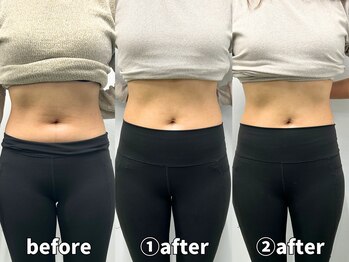 モア 札幌平岸店(MORE)/くびれの質にもこだわるのがMORE