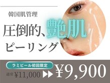 ヴィセラ(Vicella)