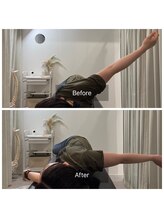 ナオル整体 広島福山院(NAORU整体)/猫背/巻き肩→Before/After