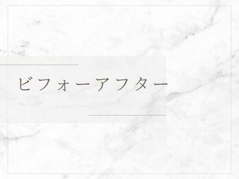 ヨサパーク ミミ 高野店(YOSA PARK mimi)/ビフォーアフター