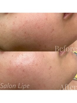 サロン リペ(Salon Lipe)/フェイスワックス