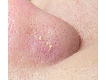 コンフィール(Confile)の写真