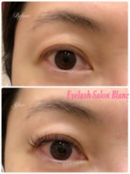 アイラッシュサロン ブラン 西新井店(Eyelash salon Blanc)/マツエク