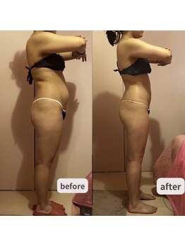 サロン ド チョコ(SALON DU CHOCO)/痩身全身