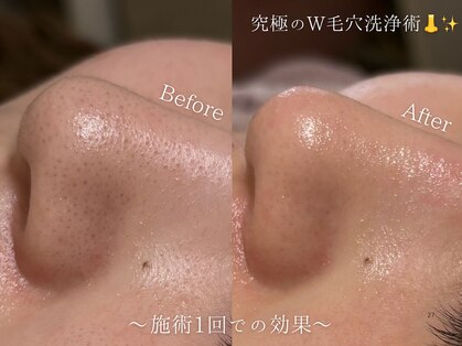 セレソル(CERESOL)の写真