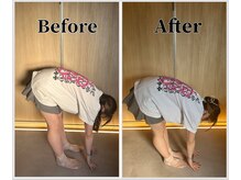 整体ラルース 中目黒(LALUZ)/20代　女性　猫背、姿勢改善