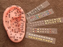 アミュレット(amulette)の雰囲気(大人気の耳つぼジュエリー!!とにかく可愛くて、効果ありで◎)