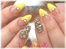 ★イエローフレンチ★