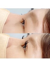 プレマージュ(Premage)/＆Healthy＋バインドロック