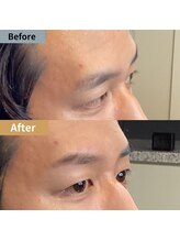 眉毛ハウス 吉祥寺店(眉毛HOUSE)/お客様の施術例(吉祥寺/東京)