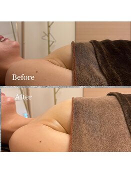 プリマベラ 大阪梅田(primabella)/デコルテから爆誕！！！