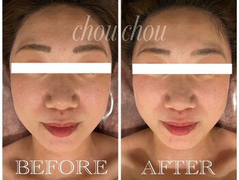 シュシュ(chouchou)