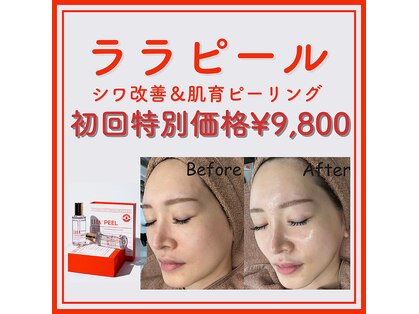 美シェリ(美Cheri)の写真