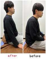 勝田台駅前整骨院/３０分以内にこうなります