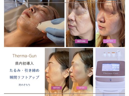 泡のきもちの写真