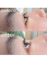 ビューティーグロウ(BEAUTY-GROW)/