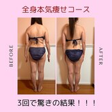 トータル フィルシャイン(Total Fillshine)