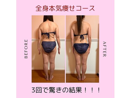トータル フィルシャイン(Total Fillshine)の写真