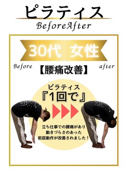 みなもと整骨院/30代　姿勢改善で腰痛解消