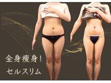 アメリオレ 国分寺店(AMELIORER)/結果出し（スーパーセルムRF+）