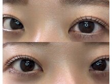 ピークアイ(Peek eye)/design parm